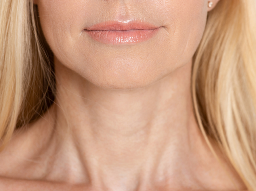 Crepey skin on the neck showing fine lines and changes in skin texture